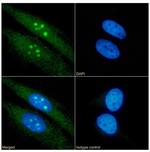 RRM2 Recombinant Rabbit Monoclonal Antibody (SAIC-30E-7)