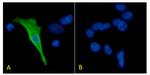 Protein C Recombinant Mouse Monoclonal Antibody (HPC-4)