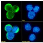 CCR5 Recombinant Rabbit Monoclonal Antibody (ST6)