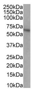 CCR5 Antibody in Western Blot (WB)