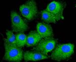 PTEN Recombinant Rabbit Monoclonal Antibody (SJ19-03)
