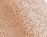 PTEN Antibody in Immunohistochemistry (Paraffin) (IHC (P))