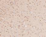 PTEN Antibody in Immunohistochemistry (Paraffin) (IHC (P))