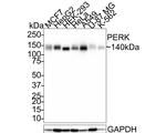 PERK Recombinant Rabbit Monoclonal Antibody (PSH0-81)