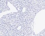 Cannabinoid Receptor 1 Antibody in Immunohistochemistry (Paraffin) (IHC (P))