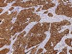 CRABP2 Monoclonal Antibody (01)