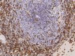 CD162 Monoclonal Antibody (07)