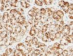 Carbonic Anhydrase IX Antibody in Immunohistochemistry (Paraffin) (IHC (P))