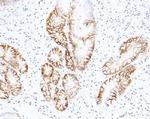 Carbonic Anhydrase IX Antibody in Immunohistochemistry (Paraffin) (IHC (P))
