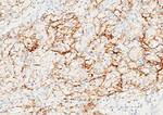 Carbonic Anhydrase IX Antibody in Immunohistochemistry (Paraffin) (IHC (P))