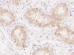 AMH Recombinant Rabbit Monoclonal Antibody (501)