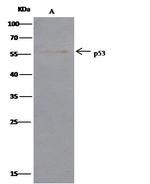 p53 Antibody in Immunoprecipitation (IP)