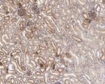 RAB1A Antibody in Immunohistochemistry (Paraffin) (IHC (P))