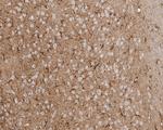 Aldolase C Antibody in Immunohistochemistry (Paraffin) (IHC (P))