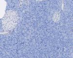 Aldolase C Antibody in Immunohistochemistry (Paraffin) (IHC (P))