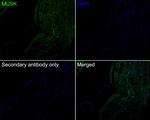 MUSK Antibody in Immunohistochemistry (Paraffin) (IHC (P))