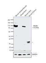 MUSK Antibody