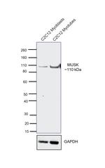 MUSK Antibody