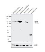 MUSK Antibody in Western Blot (WB)