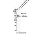 MUSK Antibody in Western Blot (WB)