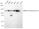 DNMT3A Recombinant Rabbit Monoclonal Antibody (23GB2230)