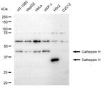 Cathepsin H Recombinant Rabbit Monoclonal Antibody (23GB3030)