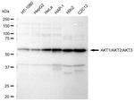 AKT Pan Recombinant Rabbit Monoclonal Antibody (23GB3180)