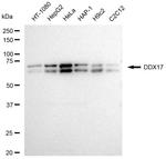 DDX17 Antibody in Western Blot (WB)