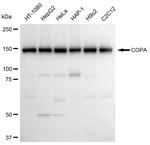 alpha COP Antibody in Western Blot (WB)