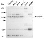 CHD1L Antibody in Western Blot (WB)