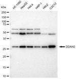 DDAH2 Antibody in Western Blot (WB)