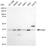 ABO Recombinant Rabbit Monoclonal Antibody (23GB3610)