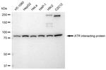 ATRIP Antibody in Western Blot (WB)