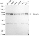 SCIN Antibody in Western Blot (WB)