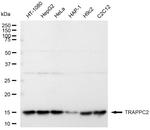 TRAPPC2 Antibody in Western Blot (WB)
