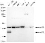 Tartrate Resistant Acid Phosphatase Antibody in Western Blot (WB)