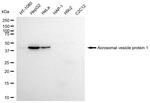 Acrosomal Vesicle Protein Antibody in Western Blot (WB)