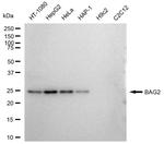 BAG2 Antibody in Western Blot (WB)