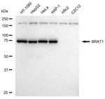 BAAT1 Antibody in Western Blot (WB)