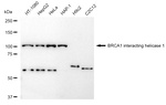 BRIP1 Recombinant Rabbit Monoclonal Antibody (23GB4360)