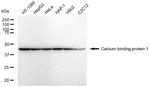 CABP1 Antibody in Western Blot (WB)