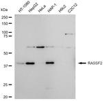 RASSF2 Antibody in Western Blot (WB)