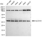 CTR1 Antibody in Western Blot (WB)
