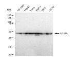 IL11RA Recombinant Rabbit Monoclonal Antibody (23GB4965)