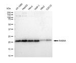 RAB8A Recombinant Rabbit Monoclonal Antibody (23GB4900)