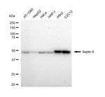 Septin-8 Recombinant Rabbit Monoclonal Antibody (23GB4905)