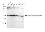 SFRP4 Recombinant Rabbit Monoclonal Antibody (23GB4950)