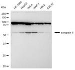 Synapsin II Recombinant Rabbit Monoclonal Antibody (23GB4960)