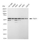 TBLR1 Antibody in Western Blot (WB)