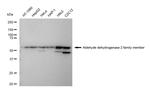 ALDH2 Recombinant Rabbit Monoclonal Antibody (23GB4810)